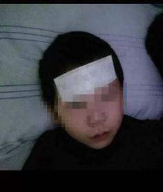 嘴唇发绀的图片,探寻健康警示信号